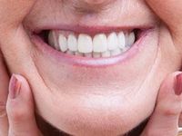 Dentures_services-spotlisting